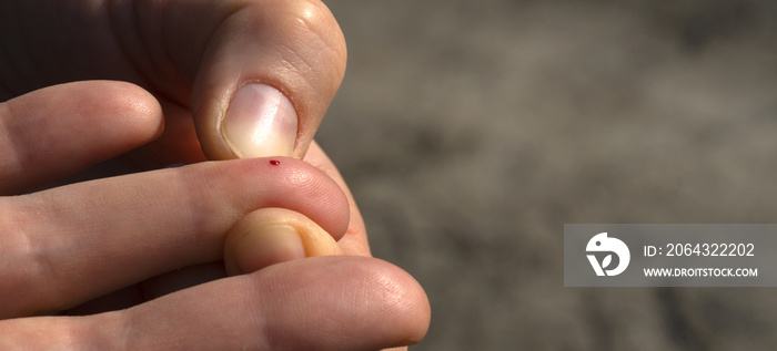 Damage to the skin on the finger, a drop of blood from a puncture on the finger, a wound on the fing