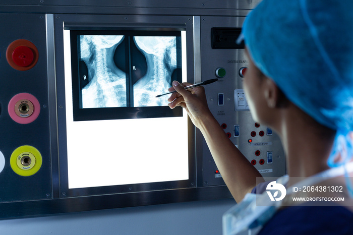 Female surgeon examining x-ray on a light box in the hospital