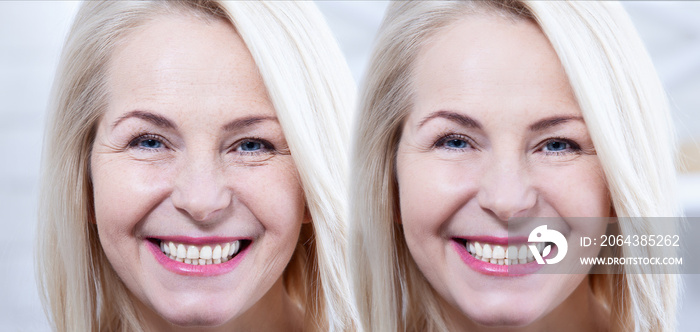 Middle age close up woman happy face before after cosmetic procedures. Skin care for wrinkled face. 