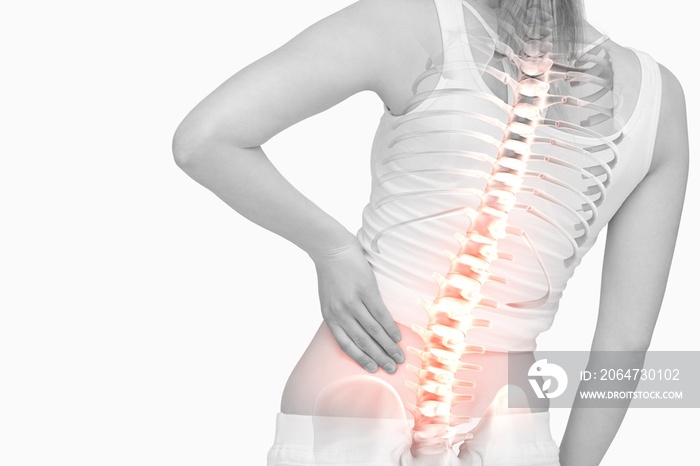 背痛女性脊椎突出