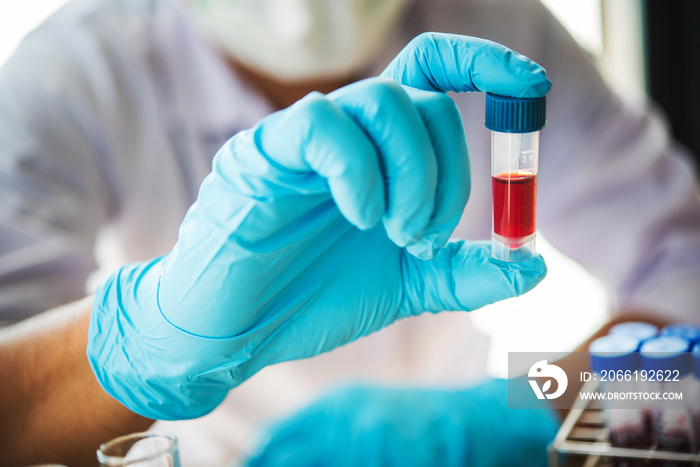 lab technician assistant analyzing a blood sample in test tube at laboratory. Medical, pharmaceutica