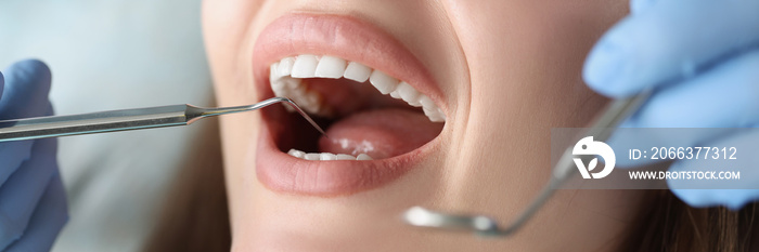 Dentist examines oral cavity of woman patient