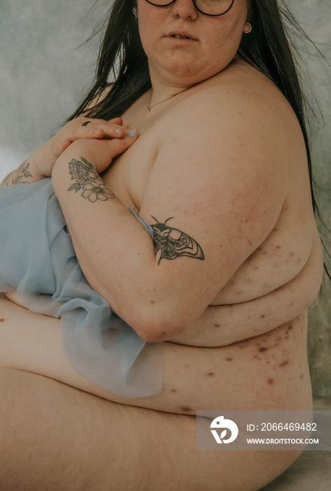 close-up of fat woman with hidradenitis suppurativa wearing glasses