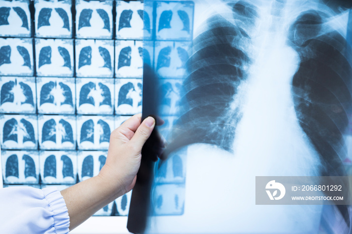 Woman doctor compare patient chest x-ray and CT scan film .Image lung at radiology department in hospital.Covid-19 scan body xray test detection for covid virus epidemic spread concept.