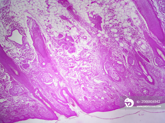 Microscope histology image of a hair follicles in skin section (40x)