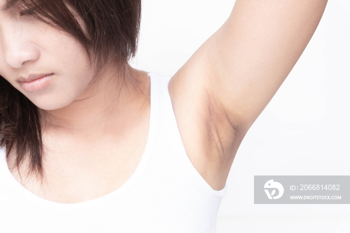 Women problem black armpit on white background for skin care and beauty concept