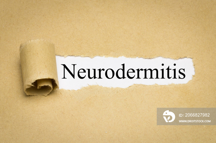 Neurodermitis