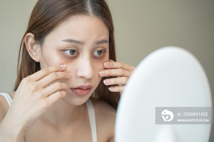 lack of sleep problem,  Worried Asian young woman pointing finger at dark circles under her eyes