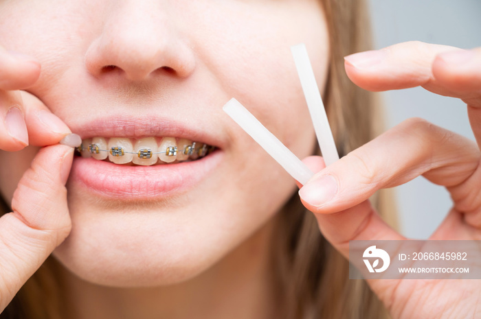 Close-up portrait of a young woman applying orthodontic anti-scratch wax to the braces