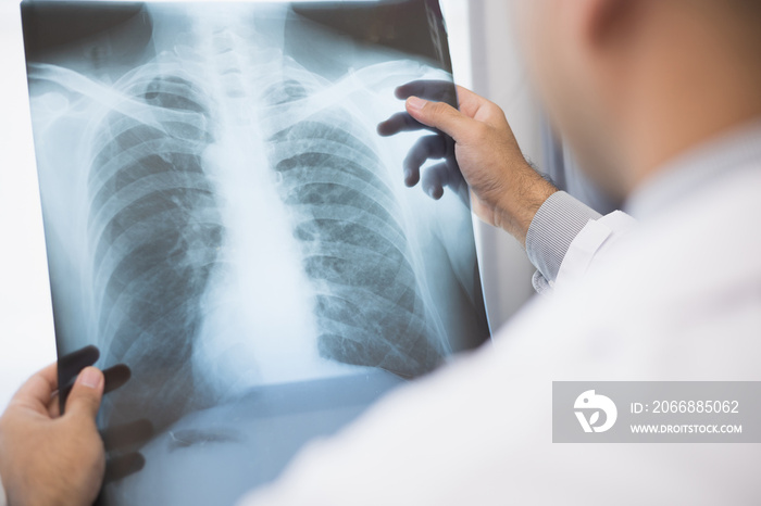 Young asian doctor working from home looking x-ray film. The patient’s symptoms from the X-ray and the results are reported online via video conferencing.