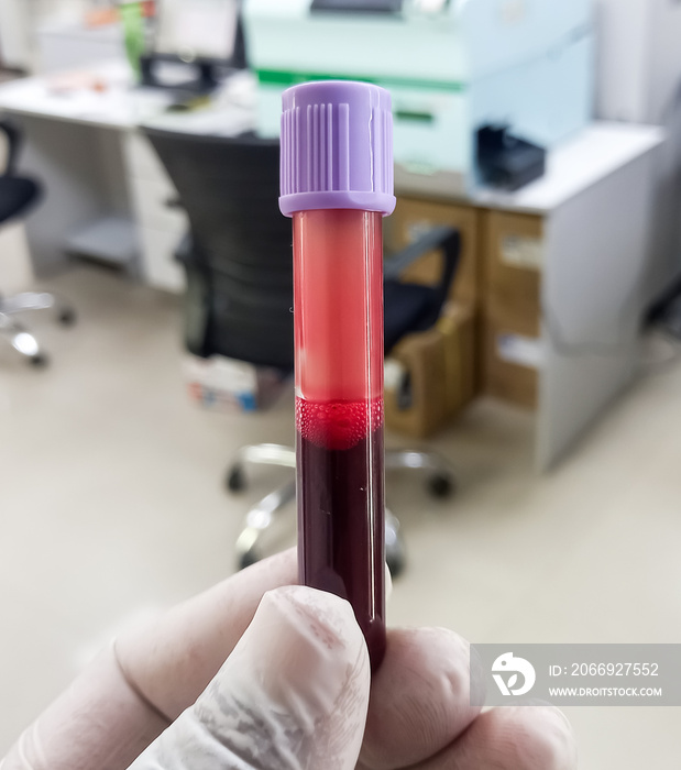 Scientist or technologist hold lavender tube with blood sample for hematological or whole blood test.