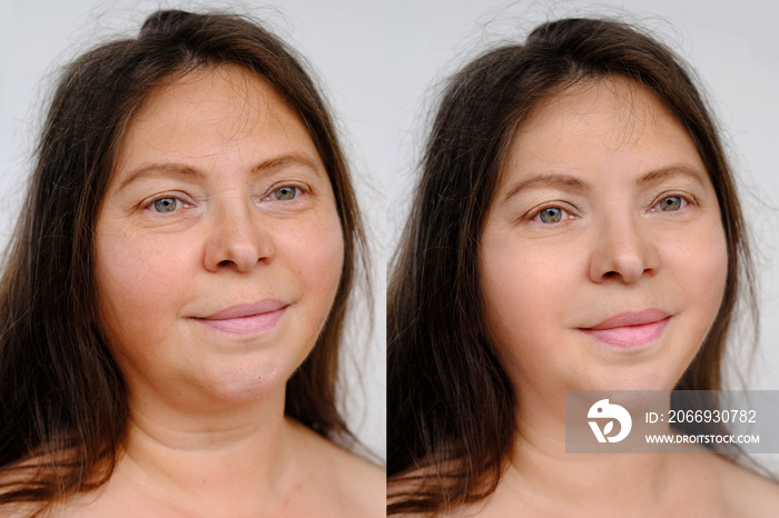 Before and after cosmetic operation. close-up of female face, neck of woman 40-50 years old with wrinkles in two versions, wrinkles on face, overhang, concept cosmetic anti-aging procedures