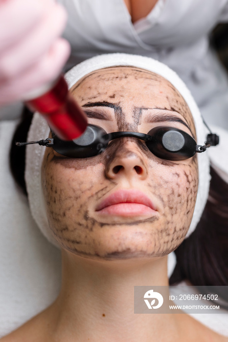 Beautician doing hardware carbon peeling to a young beautiful client in a headdress in goggles lying on a sofa in a beauty salon. Facial cleansing concept. Cosmetology services