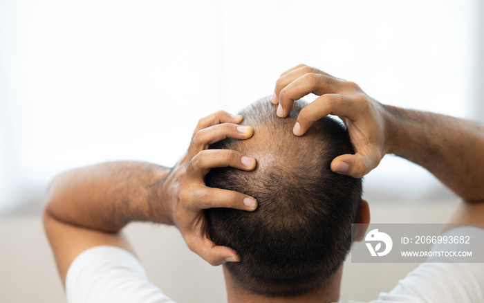 Close up man hair loss. Young man itchy head There is a fungus on the scalp dandruff red rash be scratched head to bring relief. Need to consult a doctor. Hair problems hair loss.