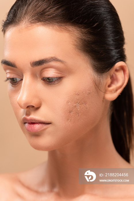 young naked woman with blemished skin isolated on beige