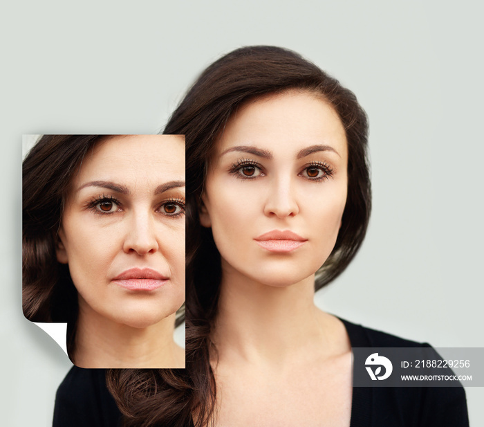 Aging. Mature woman-young woman.Face with skin problem.Showing photos before and after.