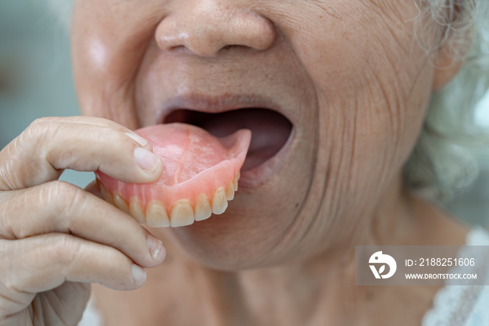 Asian senior or elderly old woman patient holding to use denture in nursing hospital ward, healthy strong medical concept