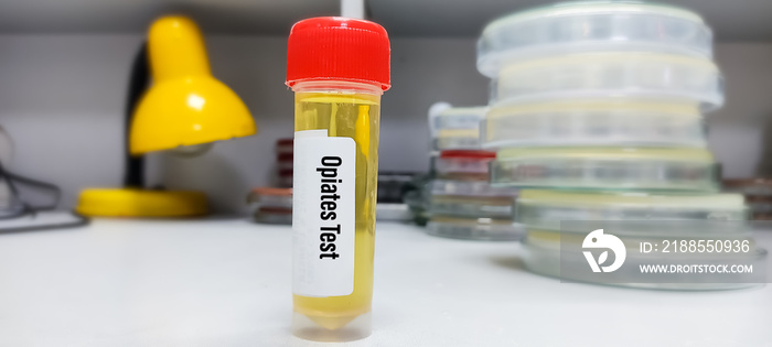 Medical laboratory container with urine sample for Opiates drugs test. Photo concept for determine presence of illegal drug in urine in judicial or medical practice.