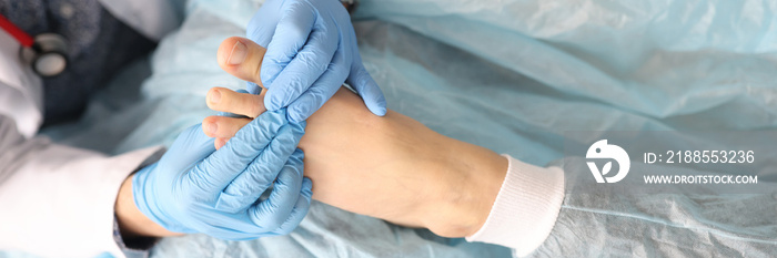 Dermatologist is holding foot of woman with damaged thumb in his hands in rubber gloves in clinic. Treatment of fungal nail infections concept.