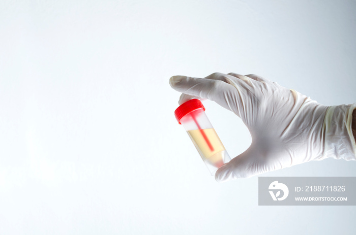 Closeup of laboratory assistant`s hand wearing white medical gloves who holding samples of urine in the plastic container against white background