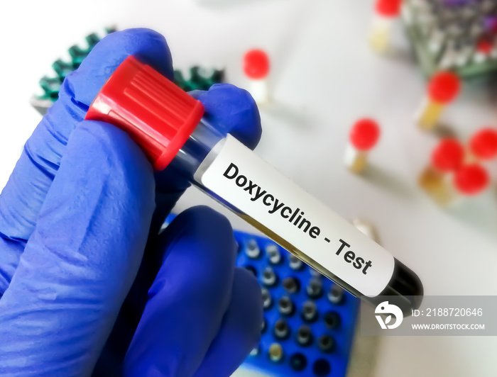 Blood sample on scientist hand for Doxycycline test, to set therapeutic range of Doxycycline.