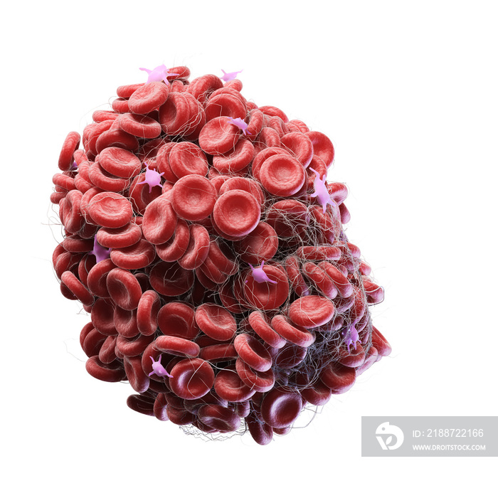 3d rendered medically accurate illustration of a blood clot