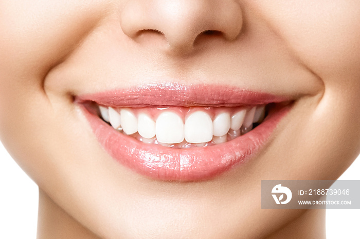 Beautiful female smile after teeth whitening procedure. Dental care. Dentistry concept