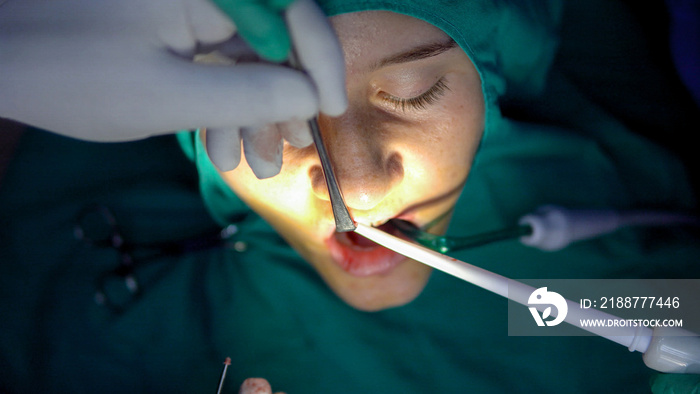 Oral surgery operation,cist apicoectomy, dark operation room