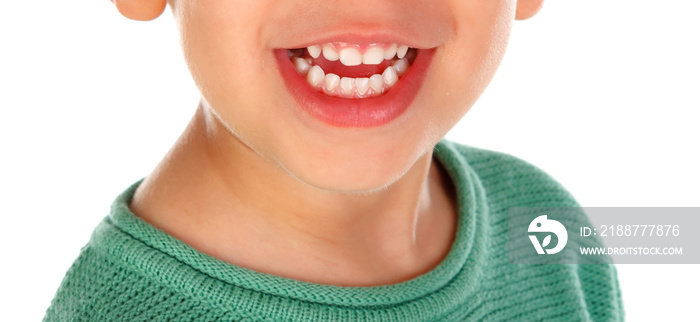 Teeth of a little child close up