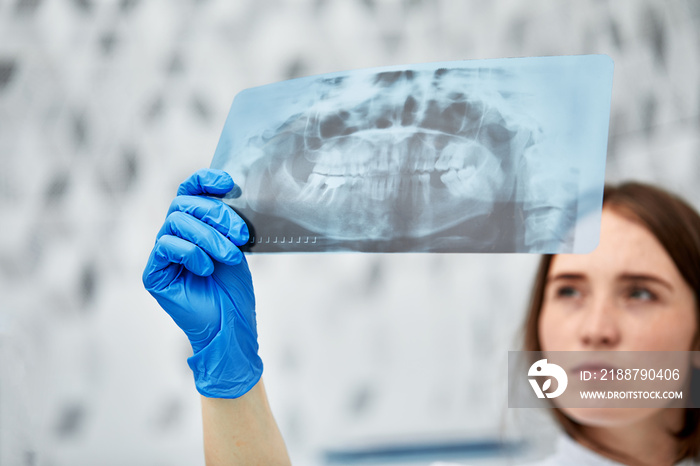 picture of female doctor or dentist looking at x-ray