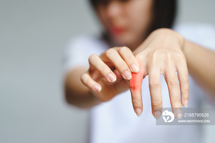 Woman’s hand with joint pain. Health care concept.