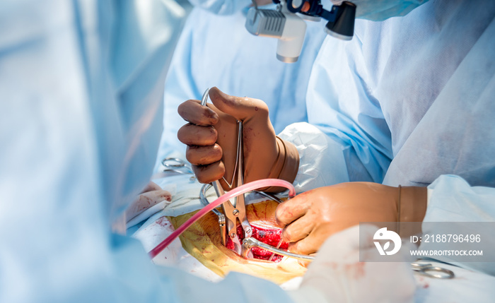 Spinal surgery. Group of surgeons in operating room with surgery equipment. Laminectomy