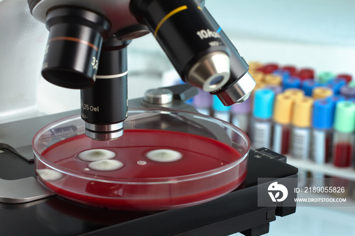 petri plate under in the laboratory microscope with tubes in background / analysis in micro of petri