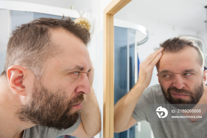 Worried man looking at his decreasing hairline