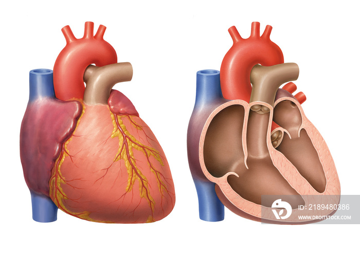 Herz mit Koronararterien