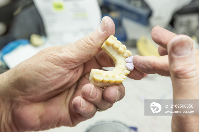 Male Dental Technician Working On A 3D Printed Mold For Tooth Implants In The Lab.