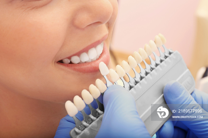 Dentist checking and selecting color of young womans teeth, closeup