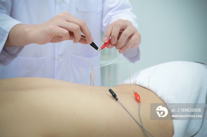 Electro Acupuncture.Traditional Chinese acupuncture and Electroacupuncture on body of patient