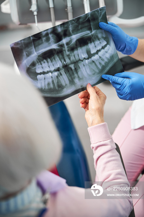 Pensioner having a look at teeth x-ray diagram