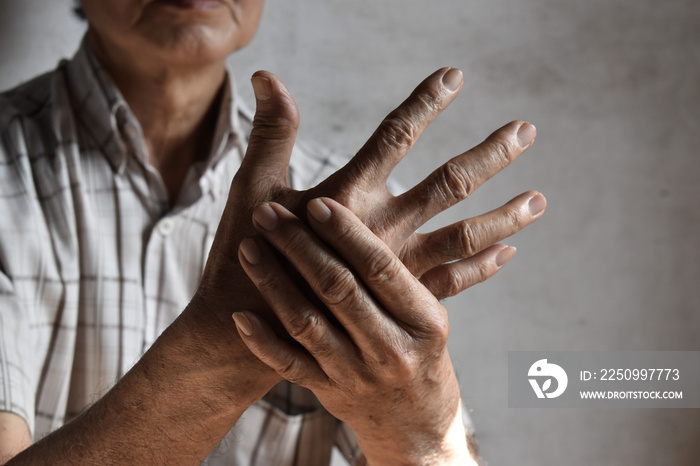 Asian man’s fingers and hand. Concept of hand pain, arthritis and finger problems.