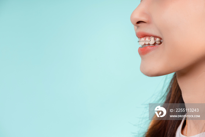 Dental Beautiful smiling of young asian woman with retainer braces glad emotion with white teeth increase confidence for healthy on blue background isolated, Happiness teenager facial expression.