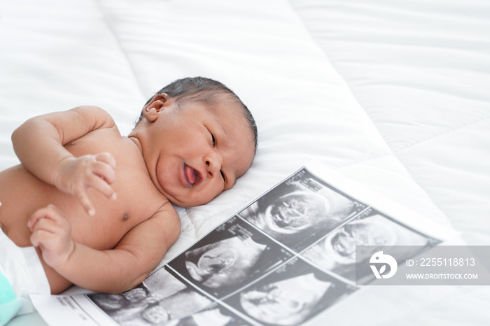 Portrait of African new born baby  with diaper lying on bedroom with fetal ultrasound image for pregnancy. White background