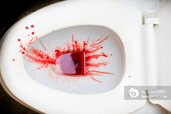 Urine is red blood urine in flush tank in the bathroom,