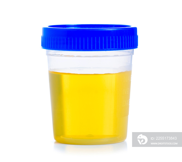 container for urine analysis on white background isolation