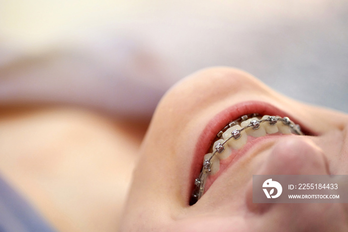 Smiling girl with braces close up.