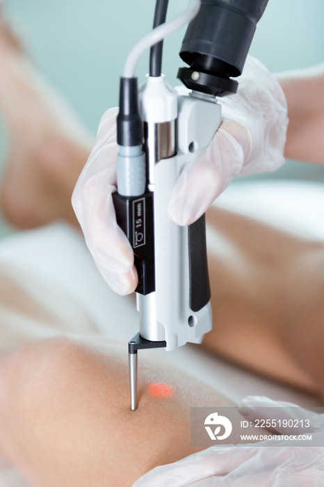 The beautician’s hands removing legs hair with a laser to her client in the beauty salon.