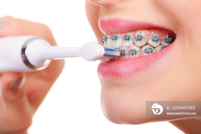 Woman brushing teeth with braces using brush