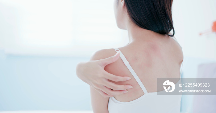 woman scratching shoulder and neck