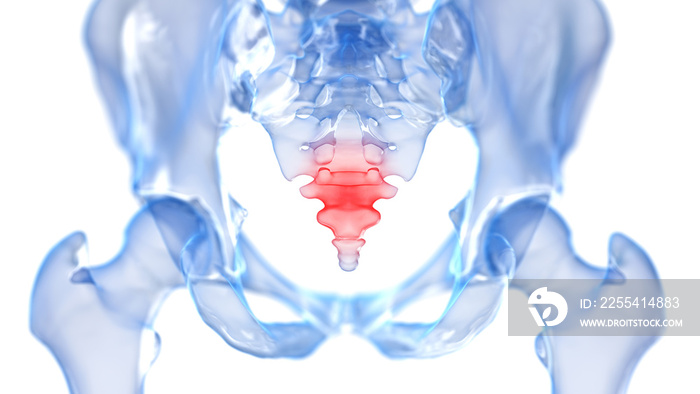 3d rendered illustration of a painful coccyx