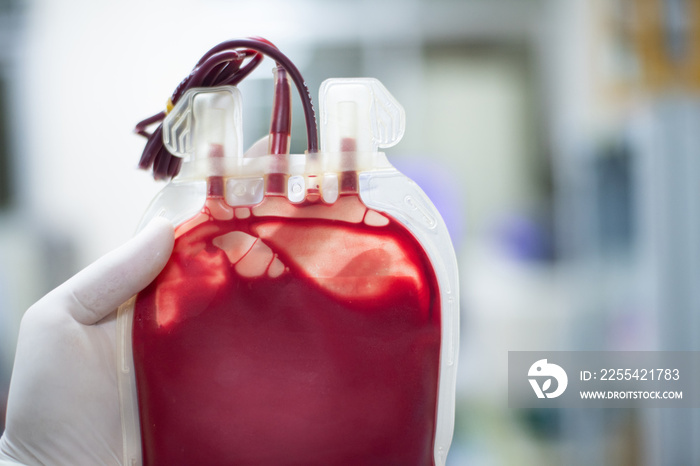 Close up red blood bag in laboratory.